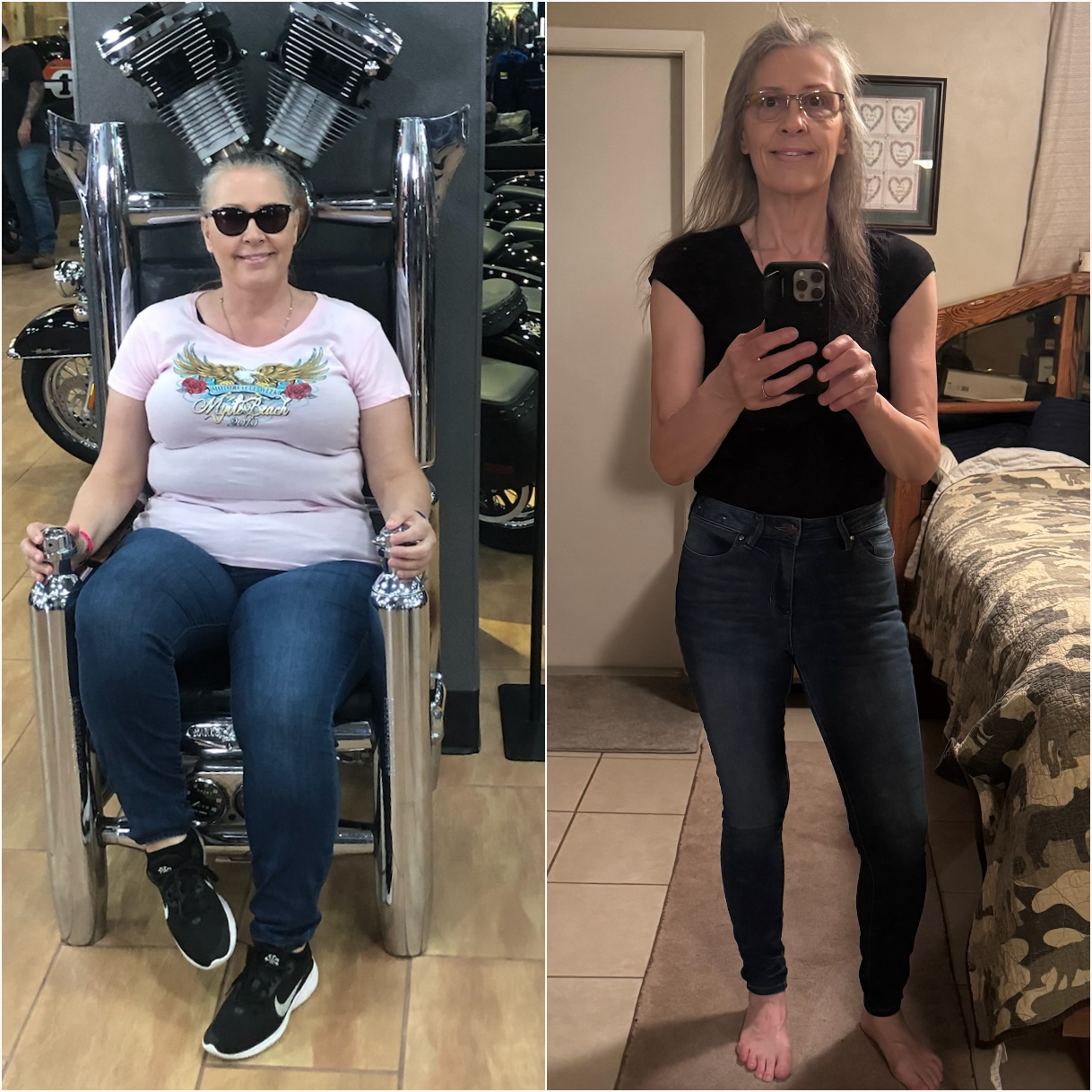 Rhonda - Before & After